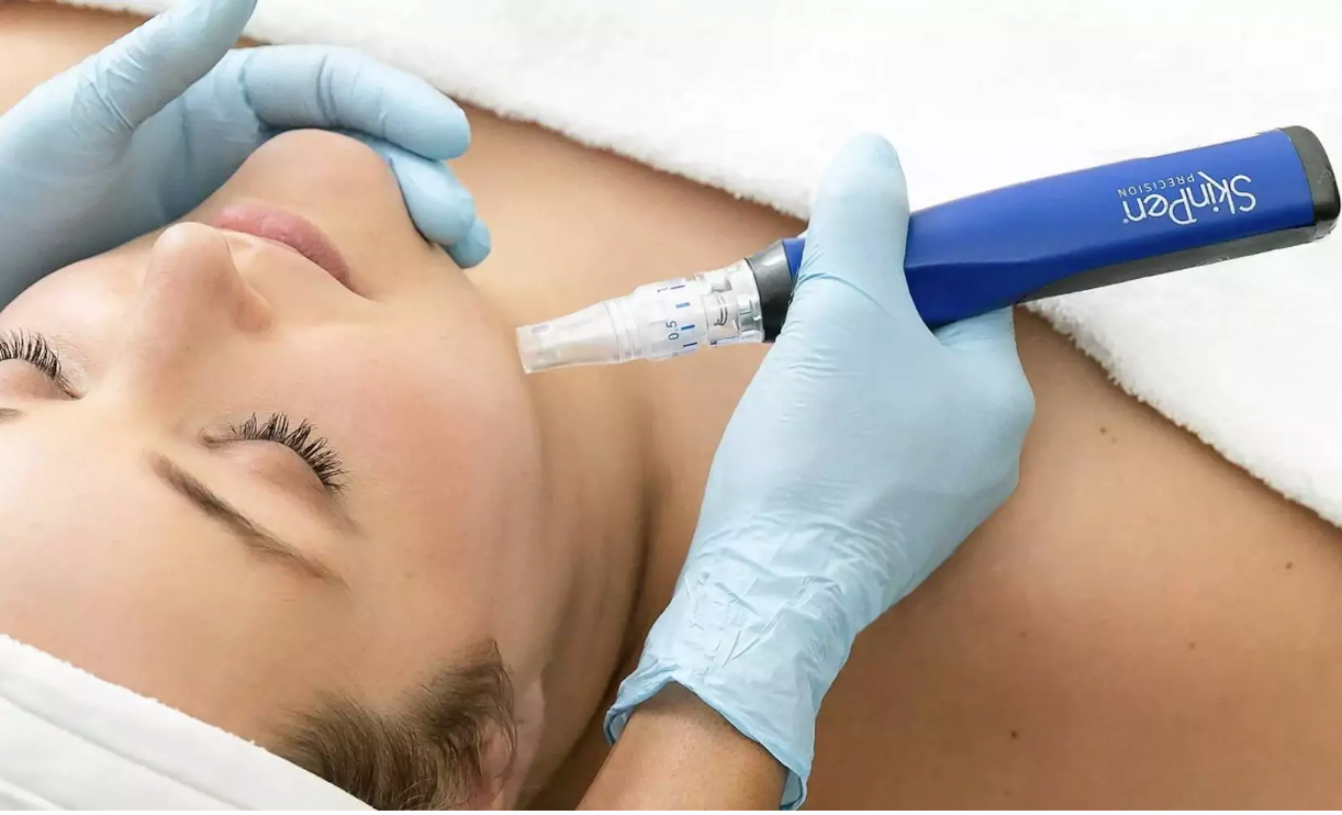 skinpen kezeles